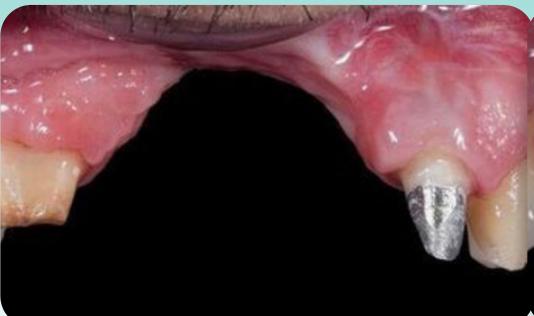 Frank's smile before treatment