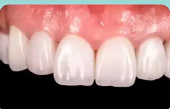 Fred's smile after treatment