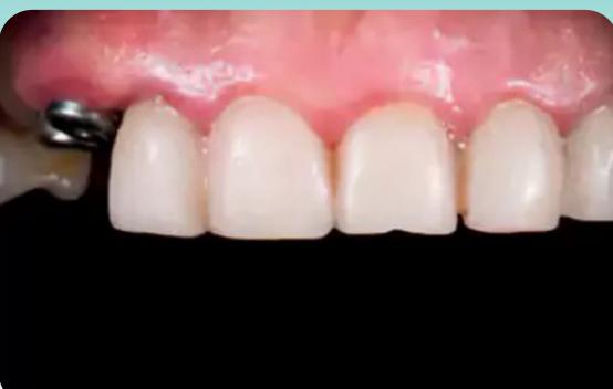 Fred's smile before treatment