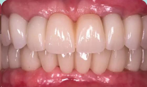 Marcelle's smile after treatment