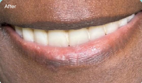 Ms. Margaret's smile after treatment