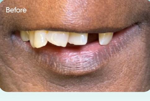 Ms. Margaret's smile before treatment