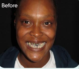 The patient's smile before treatment