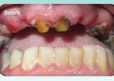 Paul's smile before treatment