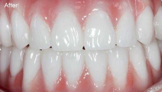 Robert's smile after treatment