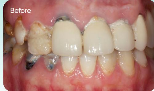 Robert's smile before treatment